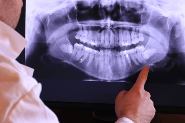 Emergency Dentist Open Today in IA